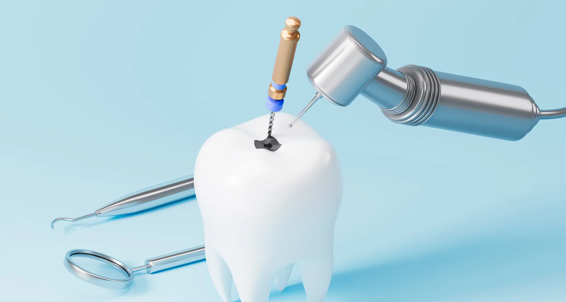 Endodoncia