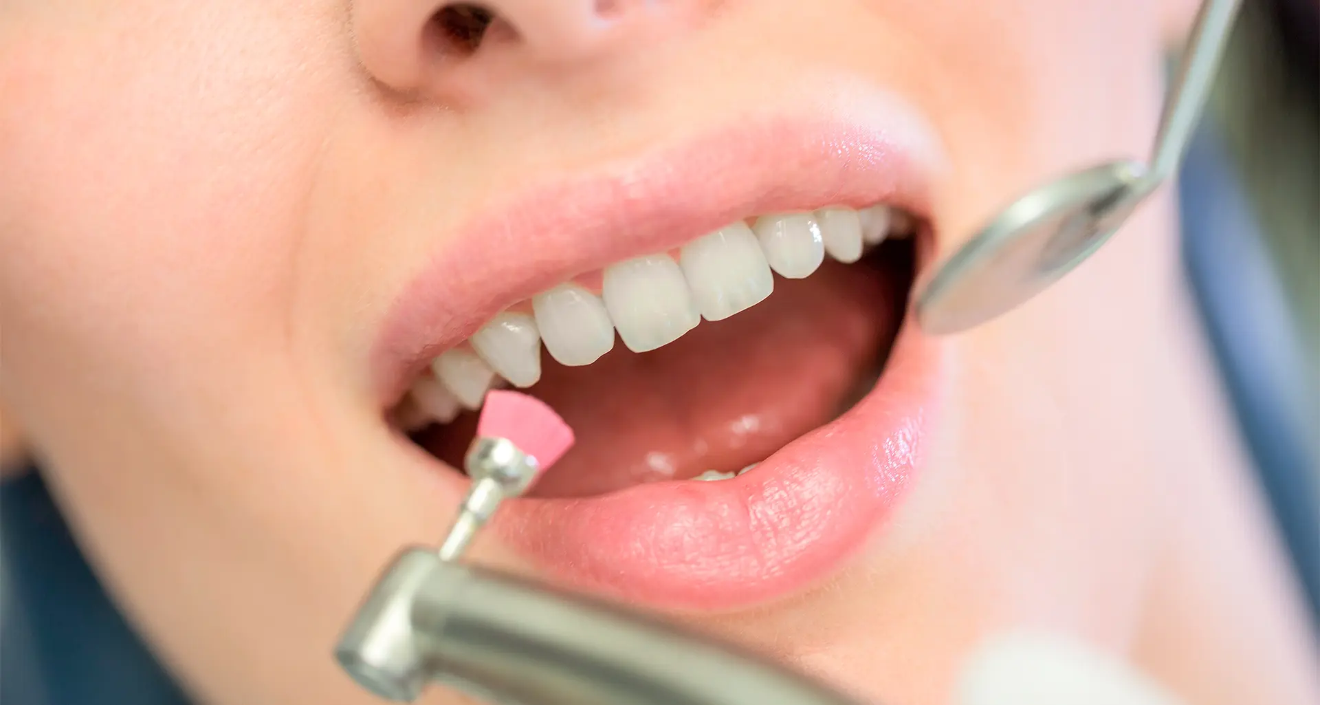 Limpieza dental