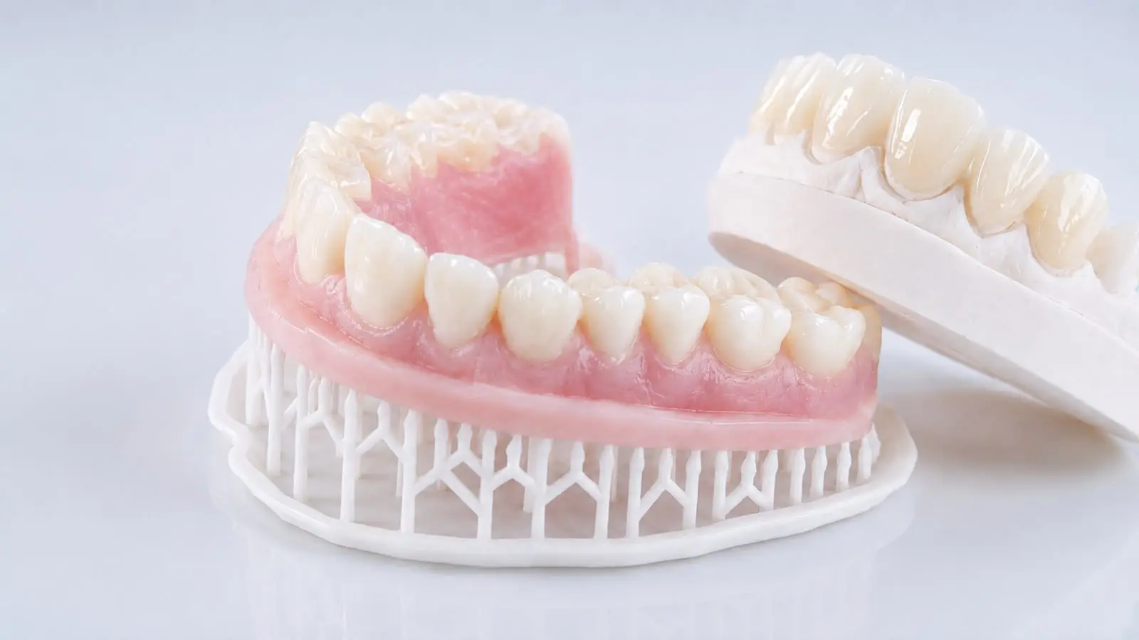 Prótesis Dental